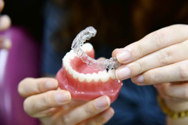 clear aligners in a denture model